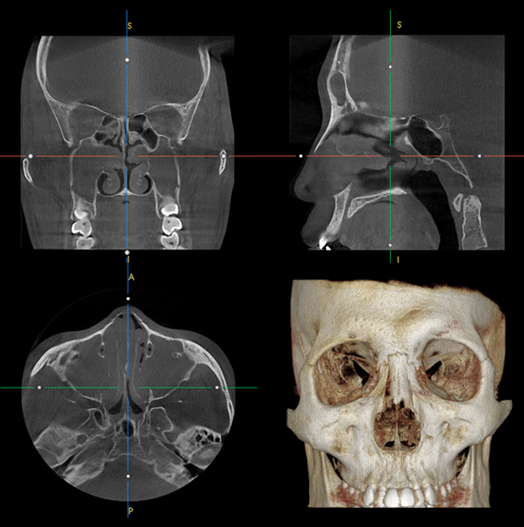 RX Dental Estacionario– PAPAYA 3D PREMIUM ENT - Image 7