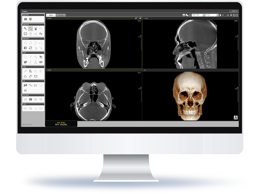 RX Dental Estacionario– PAPAYA 3D PREMIUM ENT - Image 8